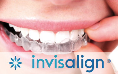 invisalign